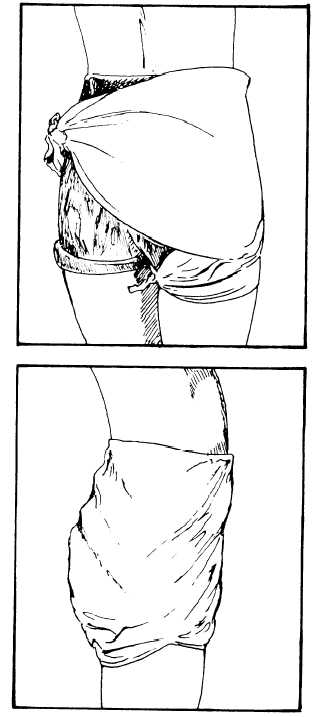Triangular bandage for the hip or buttock