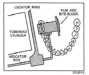Film and cylinder placement: maxillary molar area