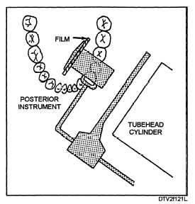 Film and cylinder placement: mandibular molar area