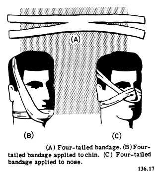 Four-tailed bandages
