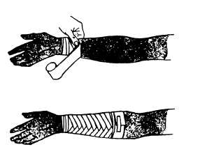 Roller bandage for the arm or leg