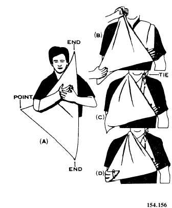 Sling for immobilizing fractured clavicle