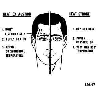 Heat exhaustion and heat stroke