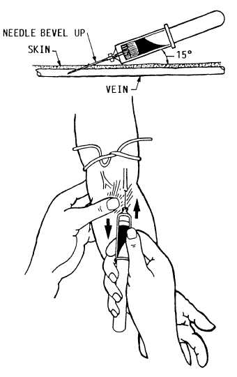 Venipuncture