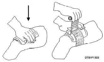 Direct pressure to control and application of a roller bandage