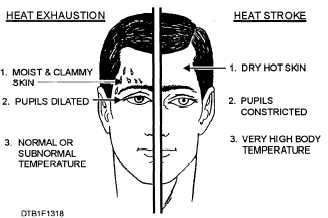 Symptoms of heat exhaustion and heat stroke