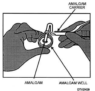 Loading amalgam into the amalgam carrier