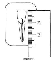 Estimated working distance using an endodontic millimeter ruler