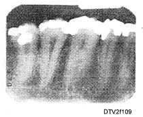 Typical periapical radiograph