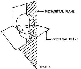 Midsagittal and occlusal planes