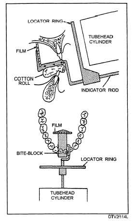 Film and cylinder placement: maxillary incisor area