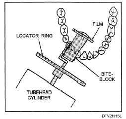 Film and cylinder placement: maxillary cuspid area