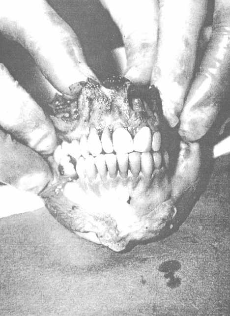 Exposed maxilla and mandible