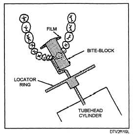 Film and cylinder placement: mandibular cuspid area