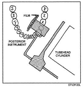 Film and cylinder placement: mandibular bicuspid area