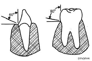 Angulation of the air polishing handpiece tip on facial and lingual surfaces of anterior and posterior teeth