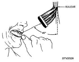 Brushing the sulcus area