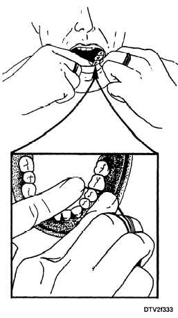 Hand position for flossing mandibular posterior teeth
